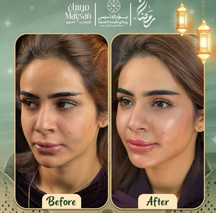 قبل وبعد